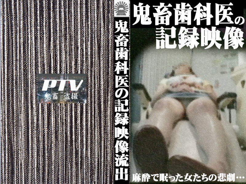 PARAT-637 巨乳患者を狙う！鬼畜歯科医の盗撮記録